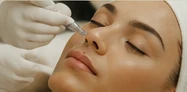 ProCell Microchanneling treatment